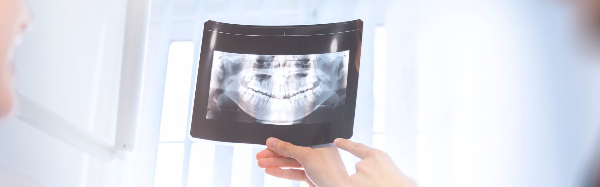 The Importance Of Dental X-Rays During An Examination