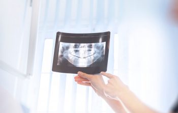 The Importance Of Dental X-Rays During An Examination